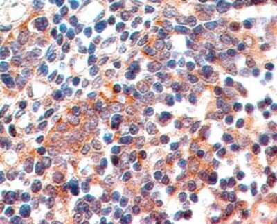 Immunohistochemistry-Paraffin: B7-1/CD80 Antibody (62N3G8) - BSA Free [NBP2-25255]