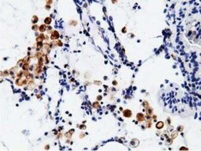 Immunohistochemistry: B7-1/CD80 Antibody (OTI2E5) - Azide and BSA Free [NBP2-70364]