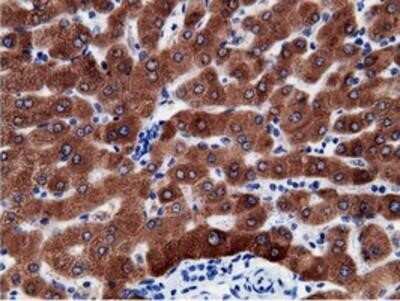 Immunohistochemistry: B7-1/CD80 Antibody (OTI2E5) - Azide and BSA Free [NBP2-70364]
