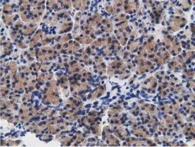 Immunohistochemistry: B7-1/CD80 Antibody (OTI2E5) - Azide and BSA Free [NBP2-70364]