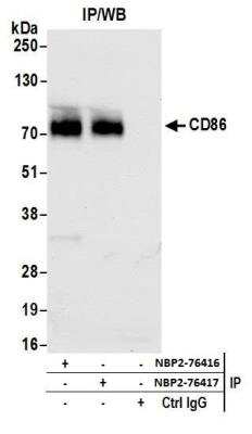 Immunoprecipitation: B7-2/CD86 Antibody (BLR030F) [NBP2-76417]