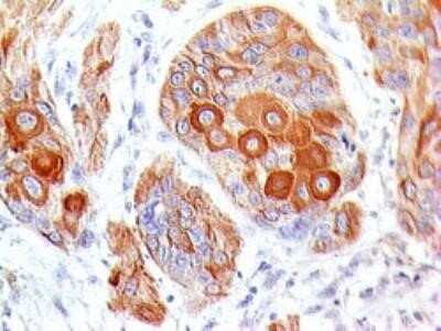 Immunohistochemistry-Paraffin: B7-2/CD86 Antibody (BU63) - Azide and BSA Free [NBP2-34569]