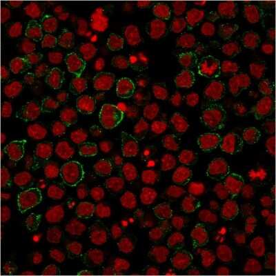 Immunocytochemistry/ Immunofluorescence: B7-2/CD86 Antibody (BU63) [NBP2-25208]