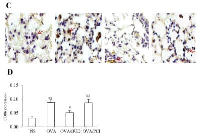 Immunohistochemistry: B7-2/CD86 Antibody (BU63) [NBP2-25208]