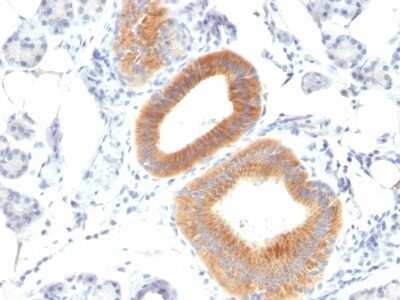 Immunohistochemistry-Paraffin: B7-2/CD86 Antibody (C86/1146) - Azide and BSA Free [NBP2-47778]