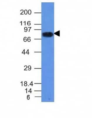 Western Blot: B7-2/CD86 Antibody (C86/1146) [NBP2-44514]