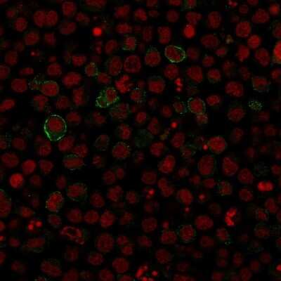 Immunocytochemistry/ Immunofluorescence: B7-2/CD86 Antibody (SPM600) - Azide and BSA Free [NBP3-11584]