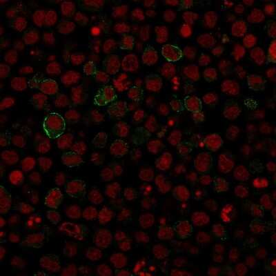 Immunocytochemistry/ Immunofluorescence: B7-2/CD86 Antibody (SPM600) [NBP2-44515]