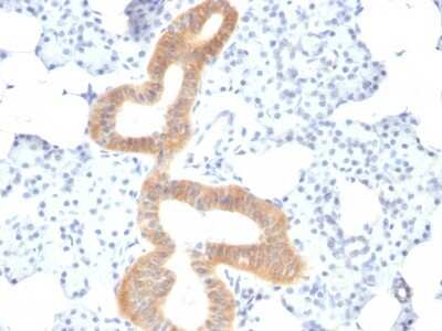 Immunohistochemistry-Paraffin: B7-2/CD86 Antibody (SPM600) [NBP2-44515]