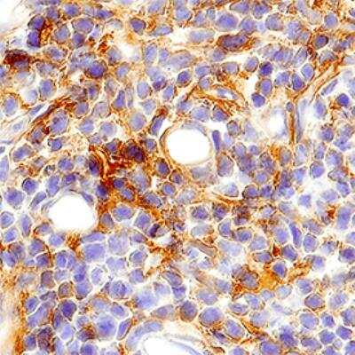 Immunohistochemistry: PD-L1 Antibody (2096A) - Azide and BSA Free [MAB90782]