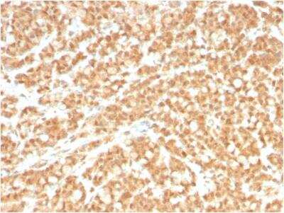 Immunohistochemistry-Paraffin: B7-H2/ICOSLG Antibody (ICOSL/3260) - Azide and BSA Free [NBP2-79932]