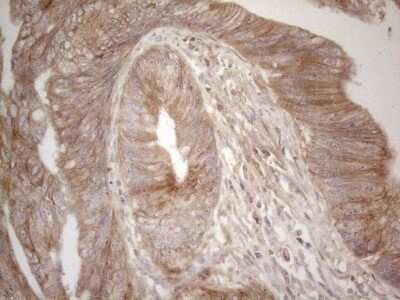 Immunohistochemistry: B7-H2/ICOSLG Antibody (OTI2C5) - Azide and BSA Free [NBP2-71735]