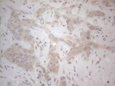 Immunohistochemistry: B7-H2/ICOSLG Antibody (OTI2C5) - Azide and BSA Free [NBP2-71735]