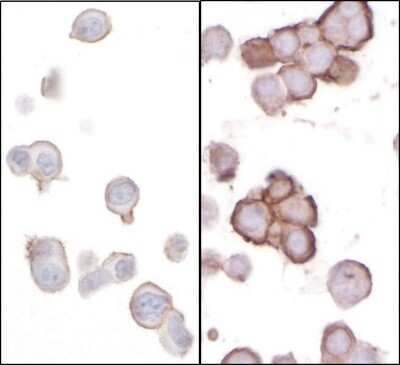 Immunohistochemistry-Paraffin: B7-H3/CD276 Antibody [NBP2-32251]