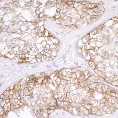 Immunohistochemistry-Paraffin: B7-H3/CD276 Antibody [NBP2-32251]