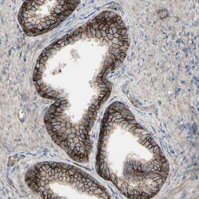Immunohistochemistry-Paraffin: B7-H3/CD276 Antibody [NBP1-88965]