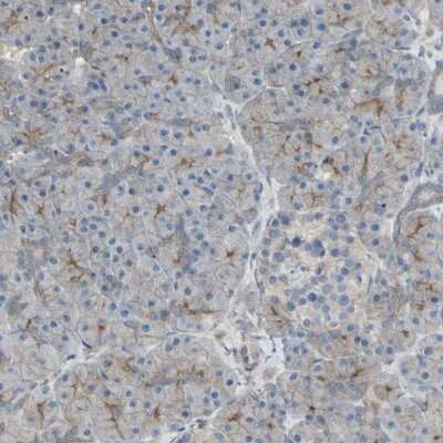 Immunohistochemistry-Paraffin: B7-H3/CD276 Antibody [NBP1-88965]