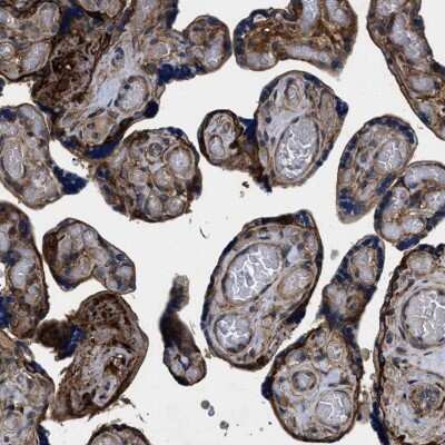 Immunohistochemistry-Paraffin: B7-H3/CD276 Antibody [NBP1-88966]
