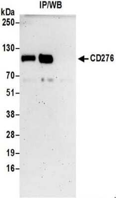Immunoprecipitation: B7-H3/CD276 Antibody [NBP2-32251]