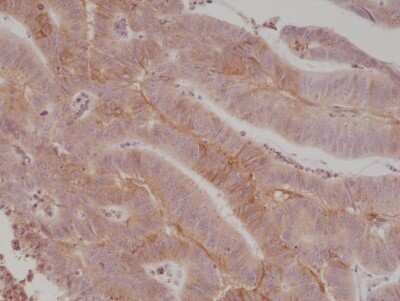 Immunohistochemistry-Paraffin: B7-H3/CD276 Antibody (RM335) [NBP2-77415]