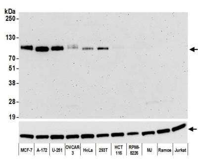 Western Blot: B7-H3/CD276 Antibody (BLR025F) [NBP3-14669]