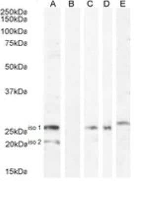 Western Blot: B7-H4 Antibody [NBP1-06096]