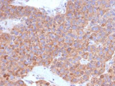 Immunohistochemistry-Paraffin: B7-H6 Antibody (B7H6/4821) - Azide and BSA Free [NBP3-08339]