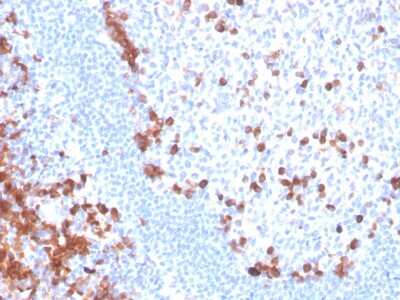 Immunohistochemistry-Paraffin: B7-H6 Antibody (B7H6/4821) - Azide and BSA Free [NBP3-08339]