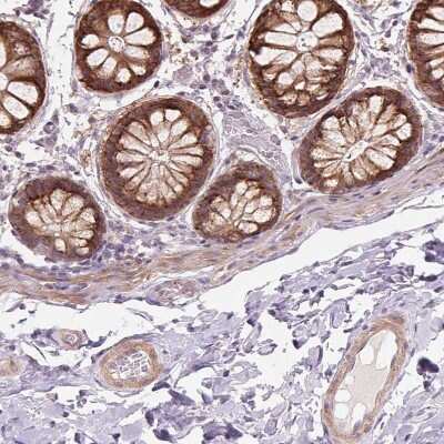 Immunohistochemistry-Paraffin: B7-H7/HHLA2 Antibody [NBP2-49187]