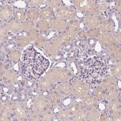 Immunohistochemistry-Paraffin: B7-H7/HHLA2 Antibody [NBP2-49187]