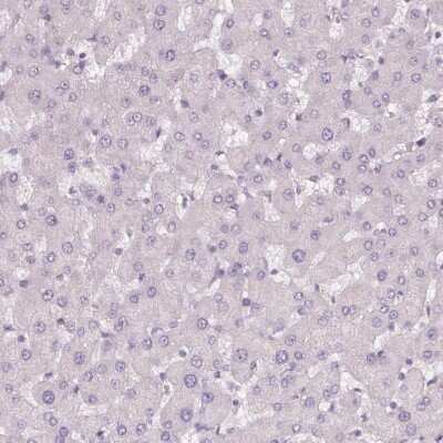 Immunohistochemistry-Paraffin: B7-H7/HHLA2 Antibody [NBP2-49187]