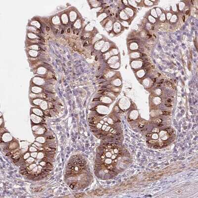 Immunohistochemistry-Paraffin: B7-H7/HHLA2 Antibody [NBP2-49187]