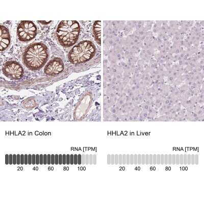 Immunohistochemistry-Paraffin: B7-H7/HHLA2 Antibody [NBP2-49187]