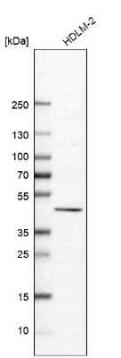 Western Blot: B7-H7/HHLA2 Antibody [NBP2-49187]