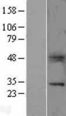 Western Blot: B7-H4 Overexpression Lysate [NBL1-17768]