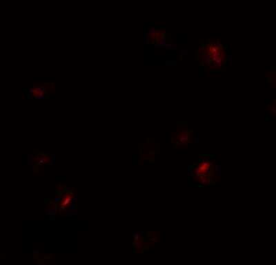 Immunocytochemistry/ Immunofluorescence: B9D1 Antibody - BSA Free [NBP2-81899]