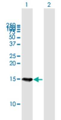 Western Blot: B9D1 Antibody [H00027077-B01P]