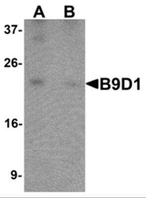 Western Blot: B9D1 AntibodyBSA Free [NBP2-81899]