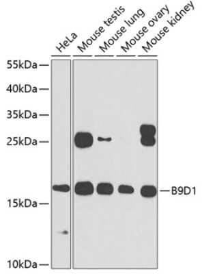 Western Blot: B9D1 AntibodyBSA Free [NBP2-92821]