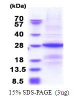 SDS-PAGE: Recombinant Human B9D1 His Protein [NBP2-51815]