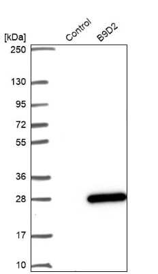 Western Blot: B9D2 Antibody [NBP1-91693]