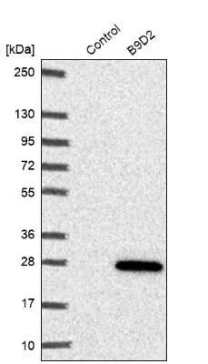 Western Blot: B9D2 Antibody [NBP1-91694]