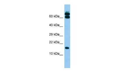 Western Blot: B9D2 Antibody [NBP2-84490]