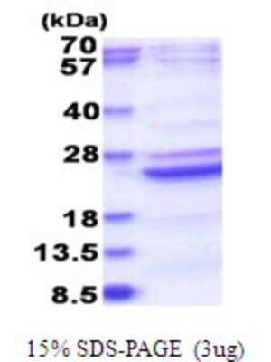 SDS-PAGE: Recombinant Human B9D2 His Protein [NBP2-51780]