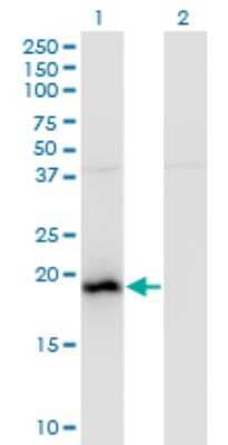 Western Blot: BAALC Antibody (2A2) [H00079870-M01]