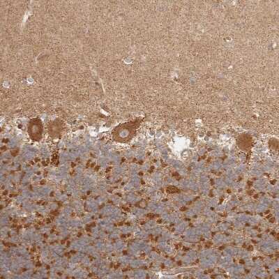 Immunohistochemistry-Paraffin: BAALC Antibody [NBP1-89443]