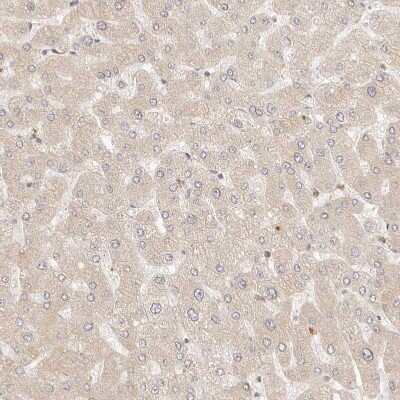 Immunohistochemistry-Paraffin: BAALC Antibody [NBP1-89443]