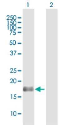 Western Blot: BAALC Antibody [H00079870-B01P]