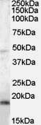 Western Blot: BAALC Antibody [NB100-2413]