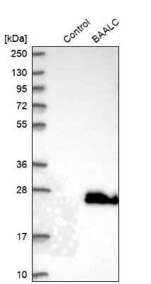 Western Blot: BAALC Antibody [NBP1-89443]